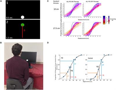 Abnormal Vision-Based Displacement Perception in Parkinson’s Disease